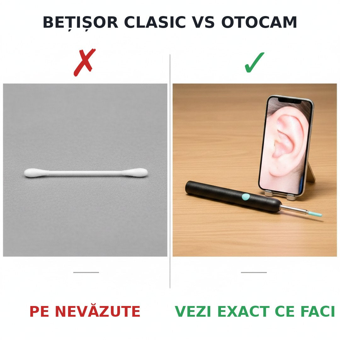 Betisor clasic vs OtoCam - comparatie